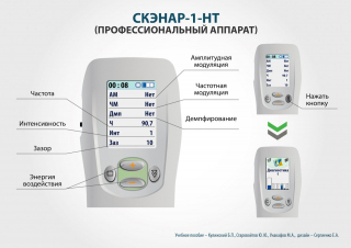 СКЭНАР-1-НТ (исполнение 01)  в Каменск-уральском купить Скэнар официальный сайт - denasvertebra.ru 